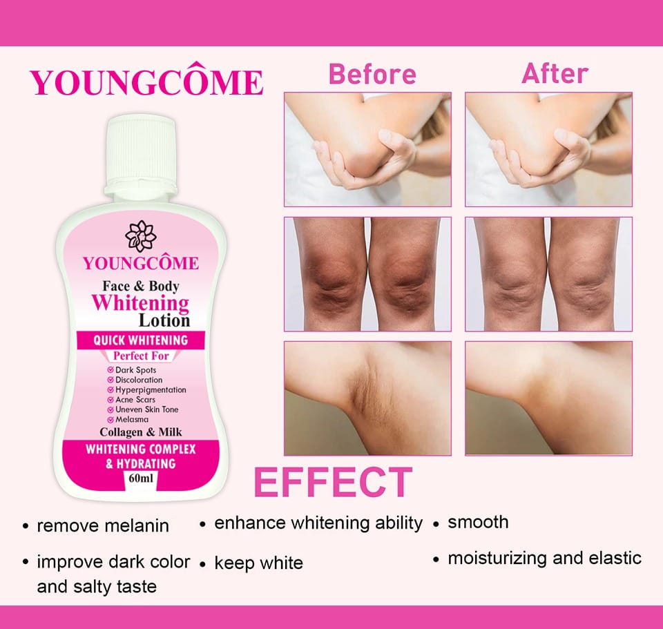 YOUNGCOME 60ml Intensive Body Whitening Lotion – Underarm & Private Part Brightening Cream | pH Balancing & Odor Eliminating Formula for All Skin Types